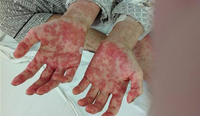 室內(nèi)甲醛檢測治理，你不得不需要了解的三點！